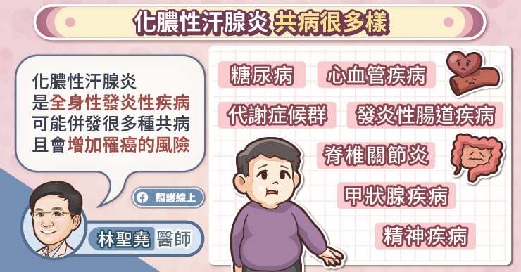 化膿性汗腺炎共病很多樣