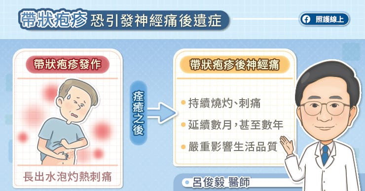 帶狀疱疹恐引發嚴重神經痛後遺症