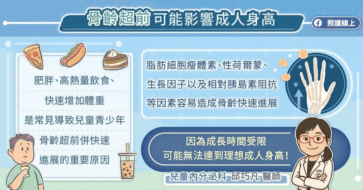 骨齡超前可能影響成人身高